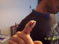 My finger got cut off