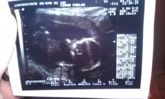 He was kicking like crazy during the ultra sound. I think he was rocking out.