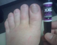 my toes lookin like vienna sausages. lol...